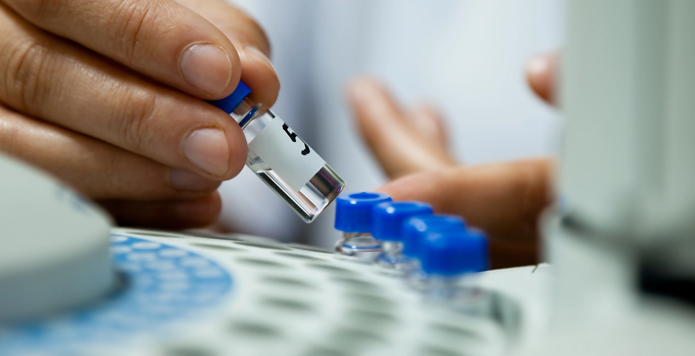 Close-up of a hand handling a vial, crucial for cancer research experiments.